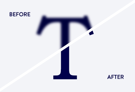 cataract before after2